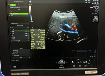Ultrasound&nbsp;|&nbsp;GE&nbsp;|&nbsp;Voluson P8 BT18