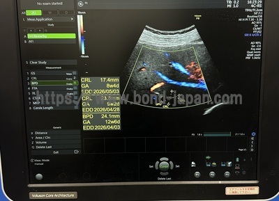 Ultrasound | GE | Voluson P8 BT18