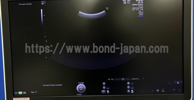 4D Ultrasound | GE | Voluson E10 BT18