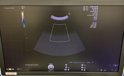4D Ultrasound&nbsp;|&nbsp;GE&nbsp;|&nbsp;Voluson E10 BT18