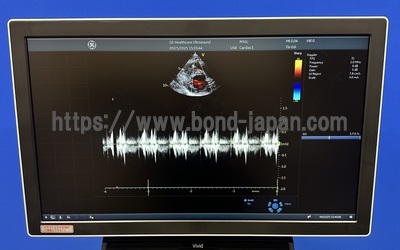 Ultrasound | GE | Vivid S60N