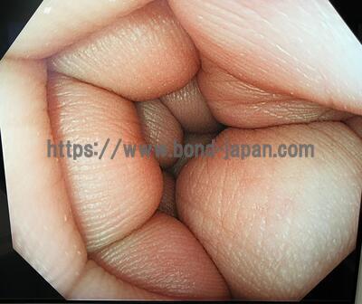 Colonoscope | OLYMPUS | CF-HQ290ZI