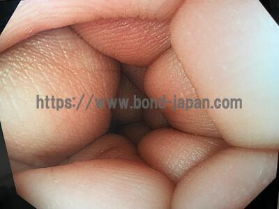 Colonoscope | OLYMPUS | CF-HQ290ZI