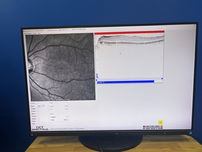 OCT | Heidelberg Engineering GmbH | SPECTRALIS OCT2