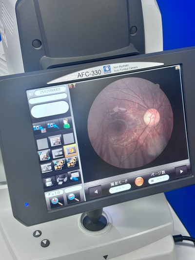 Non-Mydriatic Automated Fundus Camera | NIDEK | AFC-330