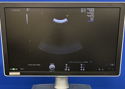 4D Ultrasound&nbsp;|&nbsp;GE&nbsp;|&nbsp;Voluson E10 BT18