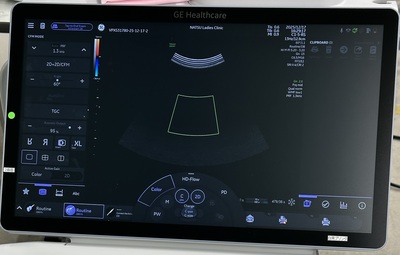 4D Ultrasound&nbsp;|&nbsp;GE&nbsp;|&nbsp;Voluson Swift BT23