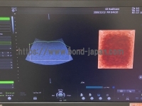 4D超音波診断装置 | CBJ | 16313