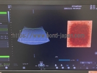 4D Ultrasound | GE | Voluson S6 BT16