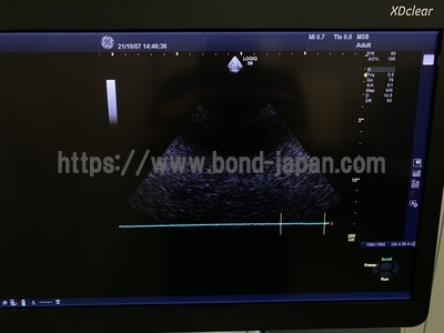 超音波診断装置/カラードプラ  | GEヘルスケア・ジャパン株式会社 | Logiq S8 XDclearの写真