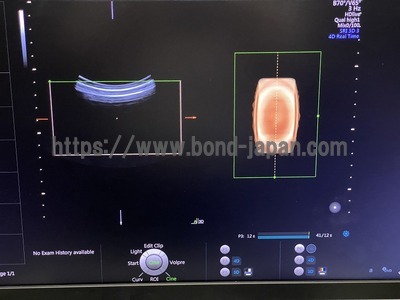 4D Ultrasound | GE | Voluson E8 BT16