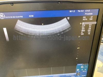 超音波診断装置/カラードプラ | GEヘルスケア・ジャパン株式会社 | LOGIQ e Premiumの写真