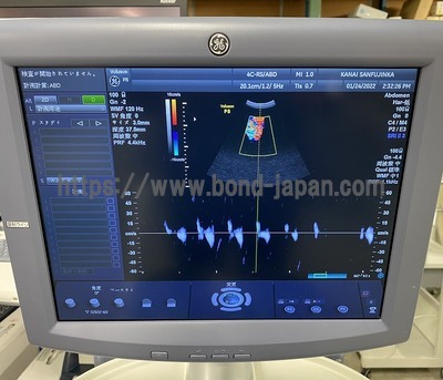 超音波診断装置/カラードプラ | GEヘルスケア・ジャパン株式会社 | Voluson P8の写真