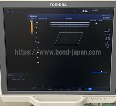 Color Doppler | CANON | TUS-X100 Xario 100