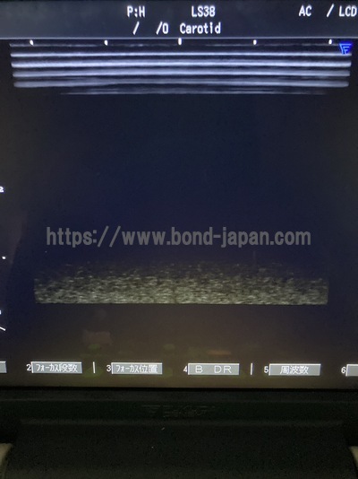 Ultrasound | FUKUDA DENSHI | UF-450AX