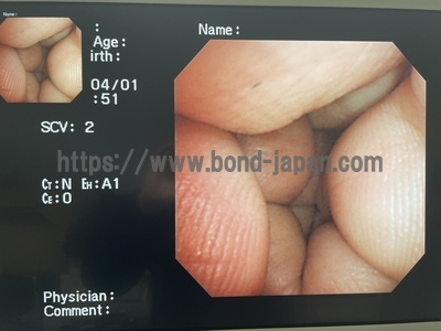 Video Bronchoscope | OLYMPUS | BF-240