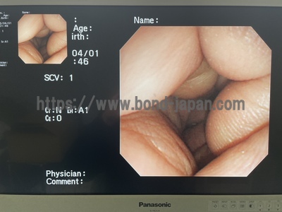 Video Gastroscope | OLYMPUS | GIF-N260