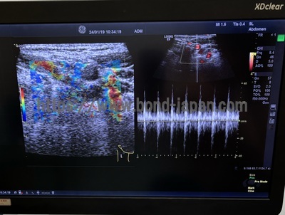 Color Doppler | GE | Logiq E9 XDclear 2.0