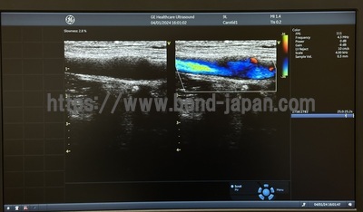 Ultrasound | GE | Vivid S60N