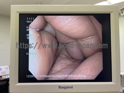 Video Gastroscope | OLYMPUS | GIF-Q150X
