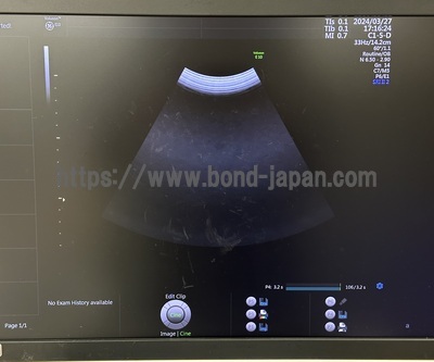 4D Ultrasound | GE | Voluson E10 BT17