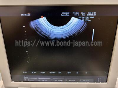 Ultrasound | Samsung Medison | SonoAce R3