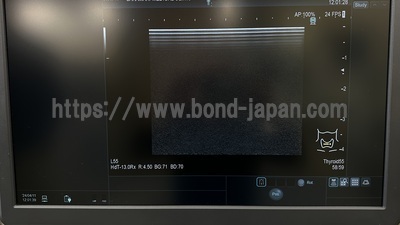 超音波診断装置 | 日立製作所 | Arietta 65の写真