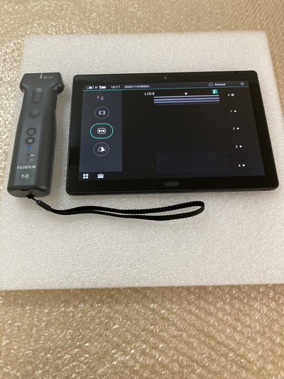 ワイヤレス超音波画像診断装置&nbsp;|&nbsp;富士フイルムメディカル株式会社&nbsp;|&nbsp;iViz air Linearの写真