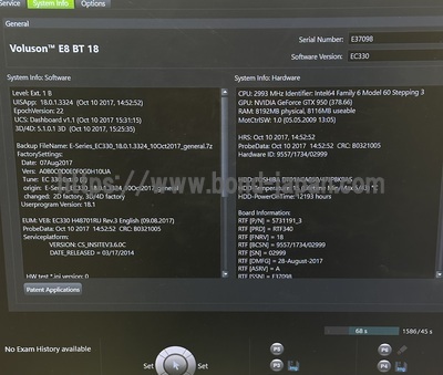 4D Ultrasound | GE | Voluson E8 BT18