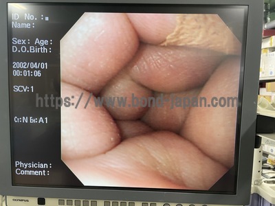 Video Gastroscope | OLYMPUS | GIF-XQ260