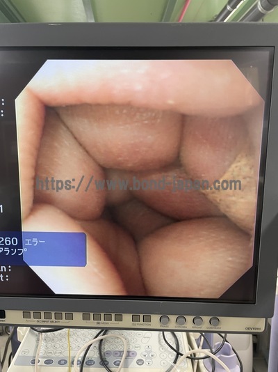 Video Gastroscope | OLYMPUS | GIF-XQ260