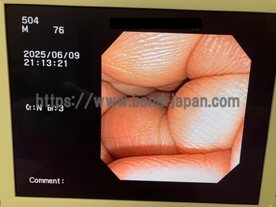 Endoscopy System | OLYMPUS | CV-150