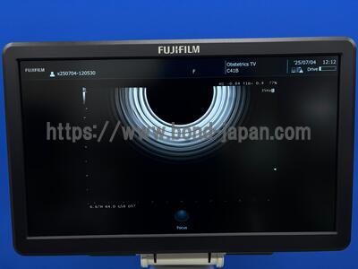 Ultrasound System | FUJIFILM | ARIETTA 50