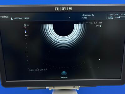 Ultrasound System&nbsp;|&nbsp;FUJIFILM&nbsp;|&nbsp;ARIETTA 50
