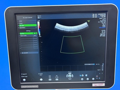Ultrasound&nbsp;|&nbsp;GE&nbsp;|&nbsp;Voluson P8 BT18