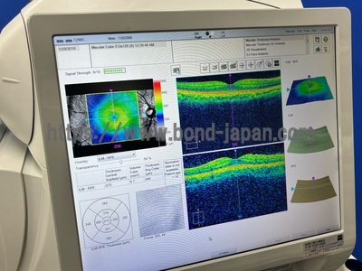 ** Great Conditioned OCT** | Carl Zeiss | Cirrus 500 HD-OCT Plus