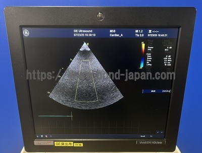 Ultrasound | GE | Vivid E9