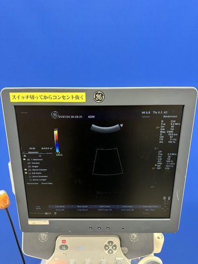 Color Doppler&nbsp;|&nbsp;GE&nbsp;|&nbsp;LOGIQ P6