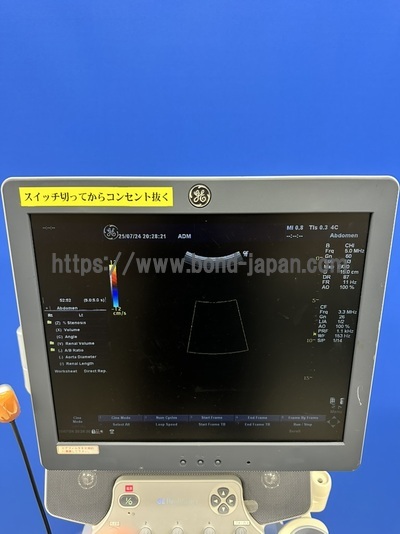 Color Doppler | GE | LOGIQ P6