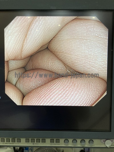 Endoscopy System | OLYMPUS | LUCERA CV-260SL