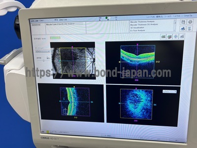 OCT | Carl Zeiss | Cirrus 500 HD-OCT Plus
