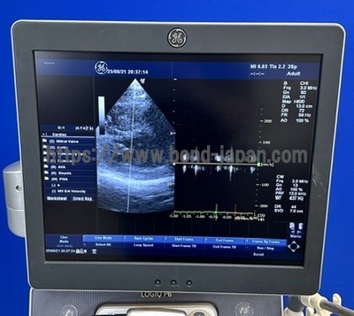 Color Doppler | GE | LOGIQ P6
