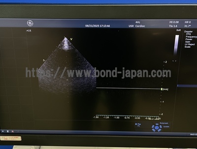 Color Doppler | GE | Vivid E95 Urtla Edition