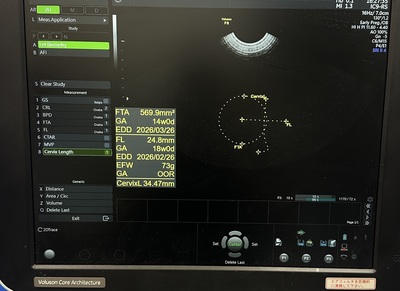 Ultrasound&nbsp;|&nbsp;GE&nbsp;|&nbsp;Voluson P8 BT18