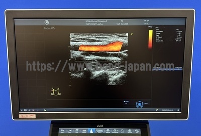 Ultrasound | GE | Vivid S60N