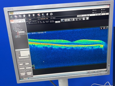 Retinal Camera and OCT Combined | NIDEK | RS-3000
