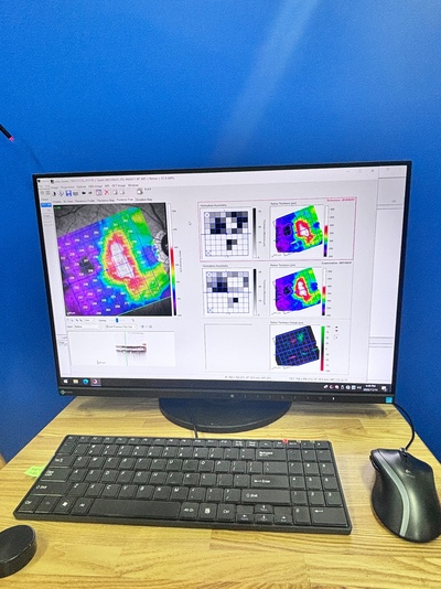 OCT | Heidelberg Engineering GmbH | SPECTRALIS OCT2