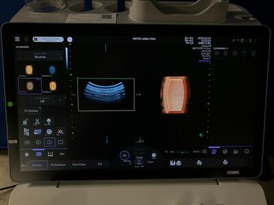 4D Ultrasound&nbsp;|&nbsp;GE&nbsp;|&nbsp;Voluson Swift BT23