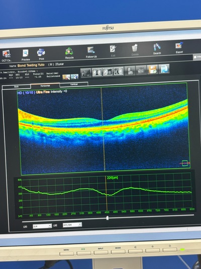 A Combination system of OCT and fundus camera&nbsp;|&nbsp;NIDEK&nbsp;|&nbsp;RS-330 Retina Scan Duo