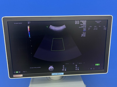 4D Ultrasound&nbsp;|&nbsp;GE&nbsp;|&nbsp;Voluson E10 BT19